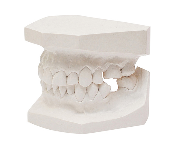 Orthodontic Study Model