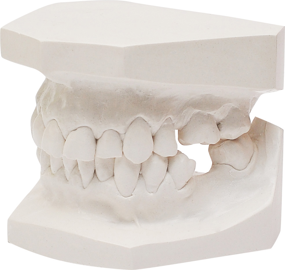 Orthodontic Study Model
